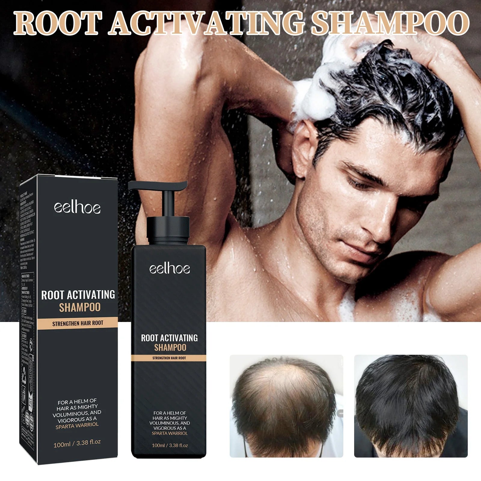 DermaScalp – Anti-Dandruff & Hair Strengthening Shampoo for Balanced Scalp